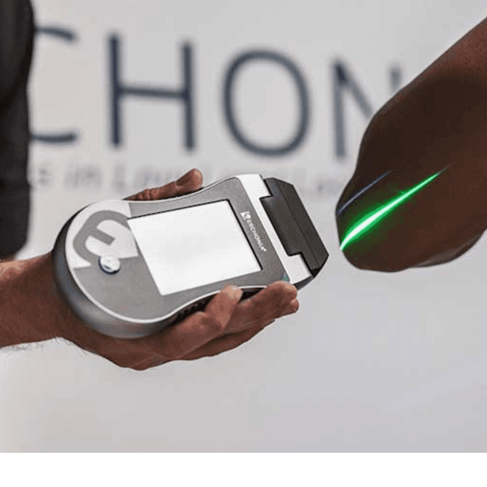 Close-up of a hand holding a device scanning a forearm with a green laser light.